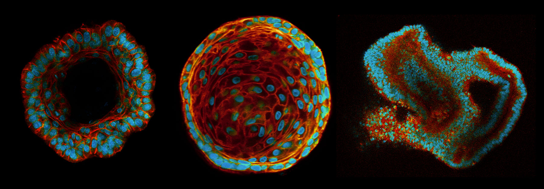 Imaging organoids